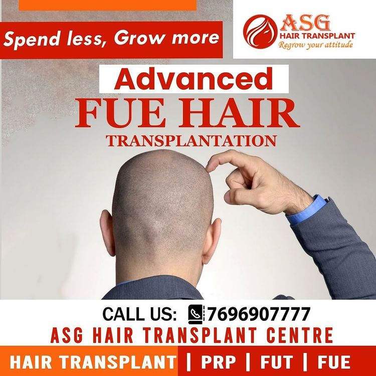 Advanced FUE Hair Transplant