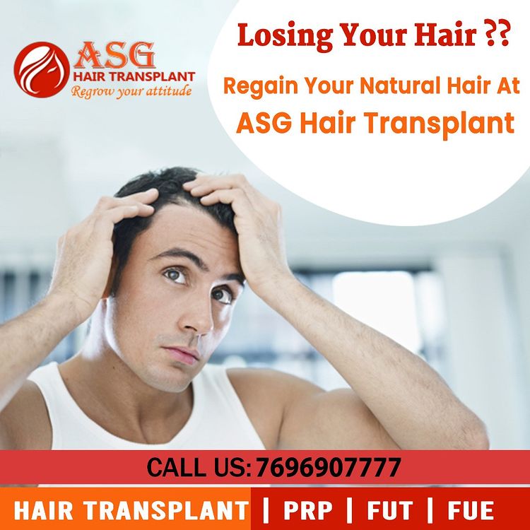 Losing your Hair? Get Hair Transplant in Ludhiana
